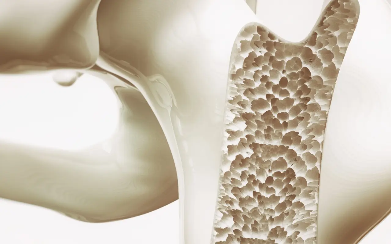 Soffri di osteoporosi? Ecco l’unico trattamento che blocca davvero la perdita di calcio